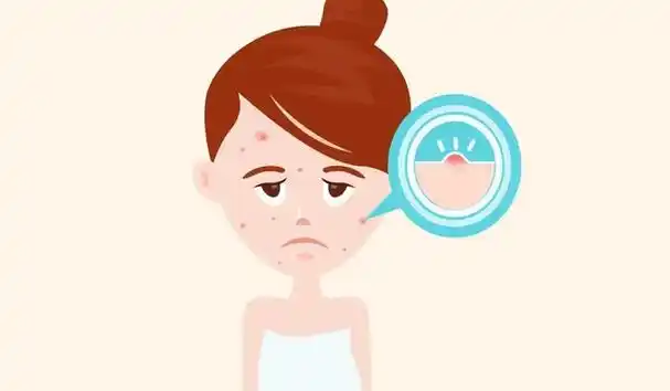 夏季皮肤出油长痘怎么办?做好这几点,轻松解决