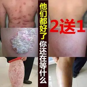 屁股长藓珍珠粒诊 男性阴茎长痘蛋蛋红白点冠状沟阴囊潮湿龟头痒