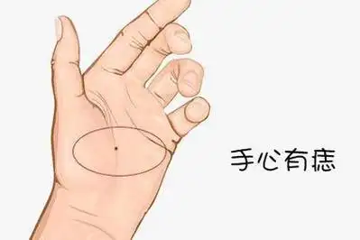 女人左手掌有痣代表什么?头脑聪明,财运旺!