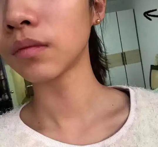 皮肤暗沉蜡黄怎么办?有没有劲儿特别猛的祛黄提亮产品推荐? - 知乎