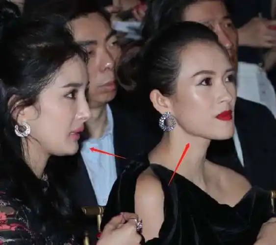 除了脸上挂不住肉,杨幂瘪嘴,下巴后缩也很厉害.