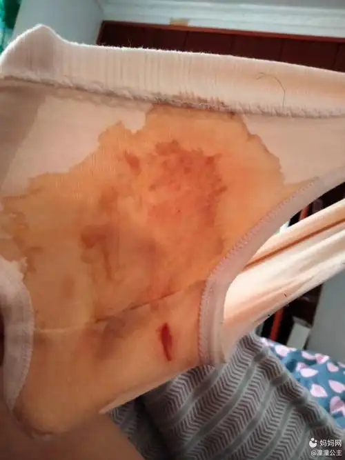 宝妈们这是不是见红了,早上起床发现内裤湿湿一看就这样了