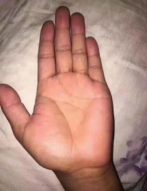 手纹金星丘是哪(手金星丘有细竖纹是怎么回事)