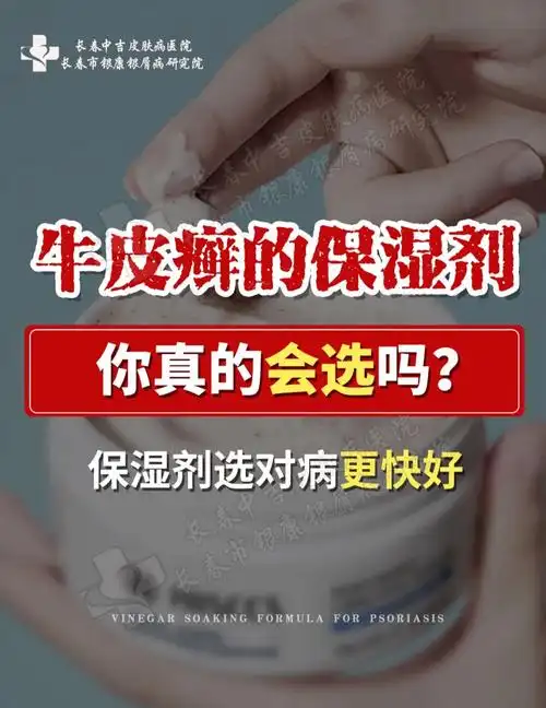 牛皮癣保湿剂怎么选学会保湿好大半60