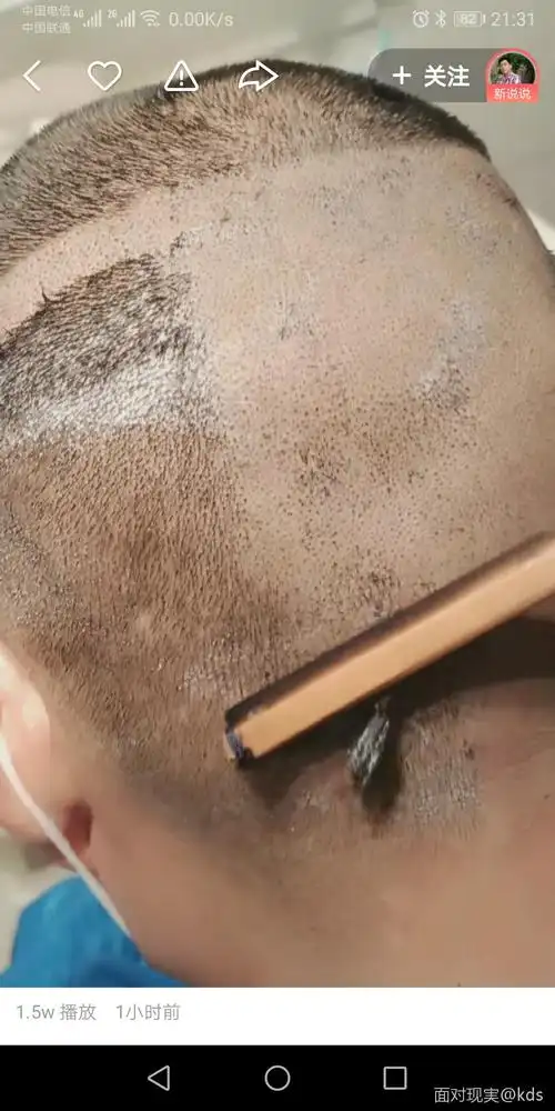 刮了光头后头皮分泌的油脂没地方去了