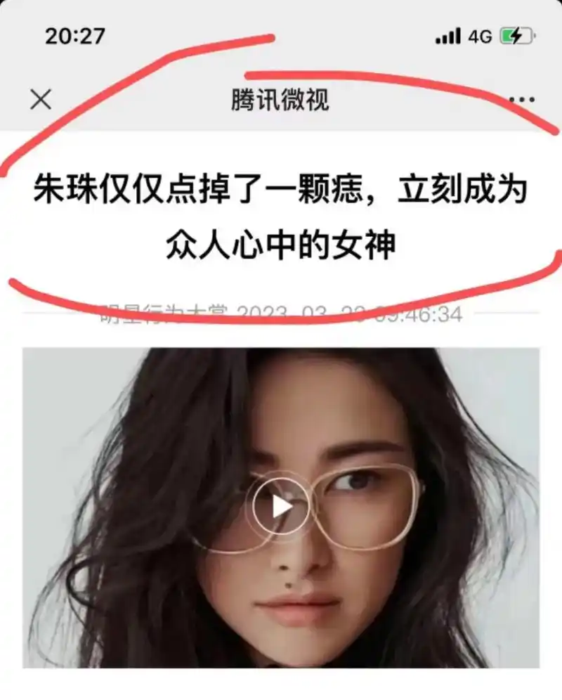 朱珠仅仅点掉了一颗痣.立刻大变样成为女神.