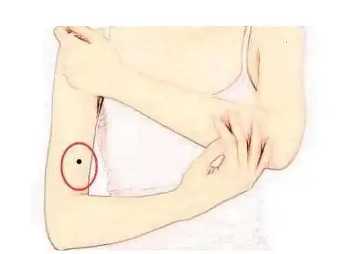 手臂有痣代表什么