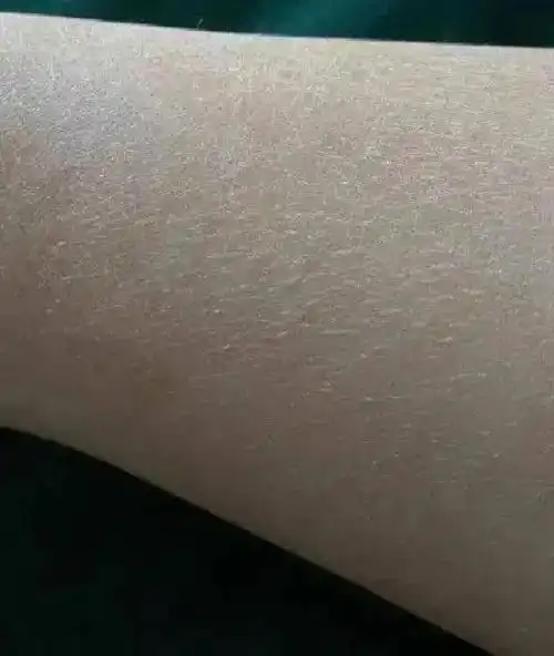 97想皮肤滑滑的96嫩嫩的么78真诚推荐8915