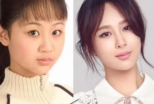 网传杨紫被整容过!