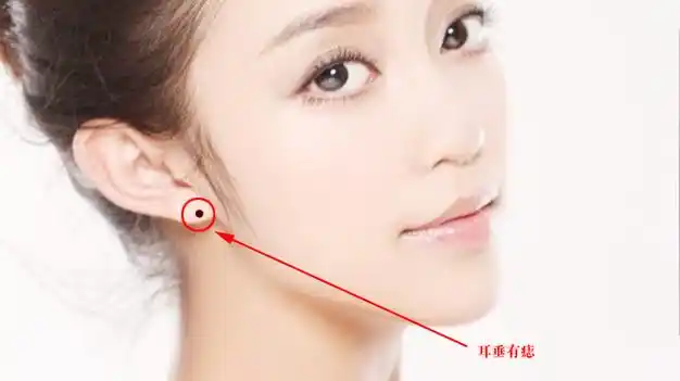 耳垂有痣耳朵主财运,健康运,厚实饱满的耳垂上长痣的朋友,是有福气之