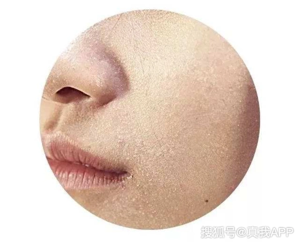 如何辨别自己的肤质?_肌肤