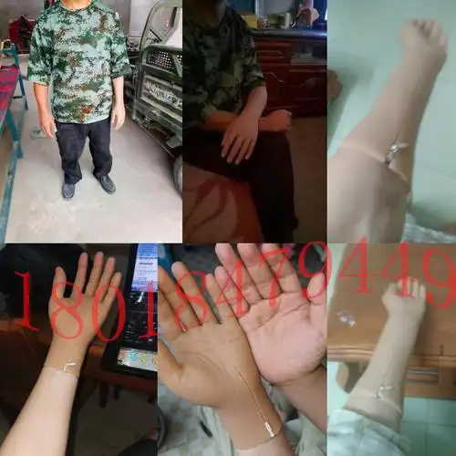 硅胶假手指套残疾人假手肢仿真定制手皮手臂义肢机械手指肌电手套