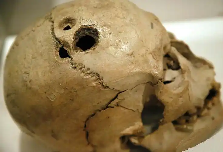 英国举办"人脑"展 爱因斯坦大脑切片亮相