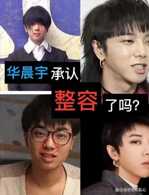 男星出道前后的颜值对比,常常让人对他们是否进行了整容手术产生疑问.