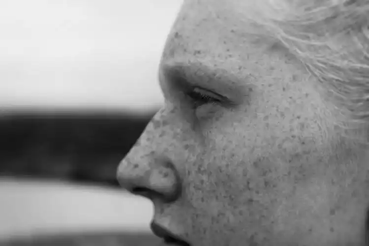 脸上有雀斑的女孩黑白图片 其他人物,女孩,五官特写,人物表情,黑白照