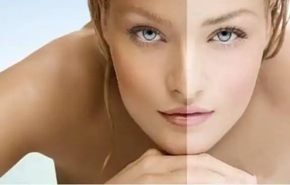 皮肤比较黑怎么办,教你4个美白方法,由内往外净白肌肤