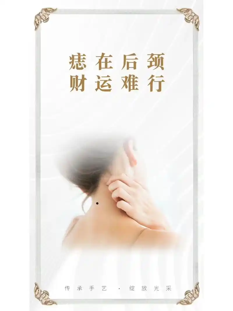 点掉不好的痣,让好运财