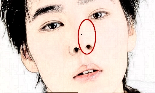 鼻子的准头又是鼻头,这个地方长痣的人,自控力不足,容易冲动,这种人