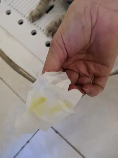 比如服用了黄色的药物或是b族维生素等,受到色素的影响,都会导致尿液