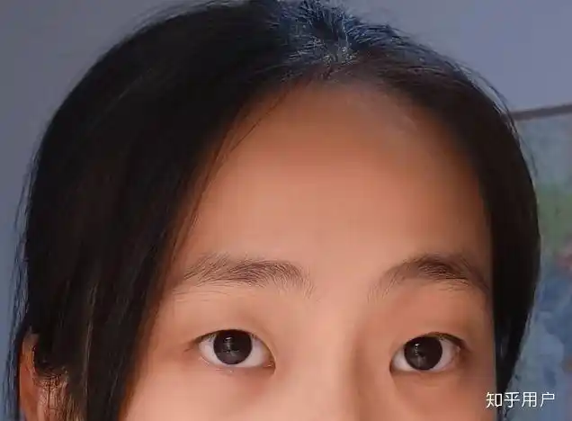 内双的人眼皮长什么样? - 知乎