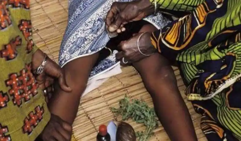 割礼,是一种宗教仪式