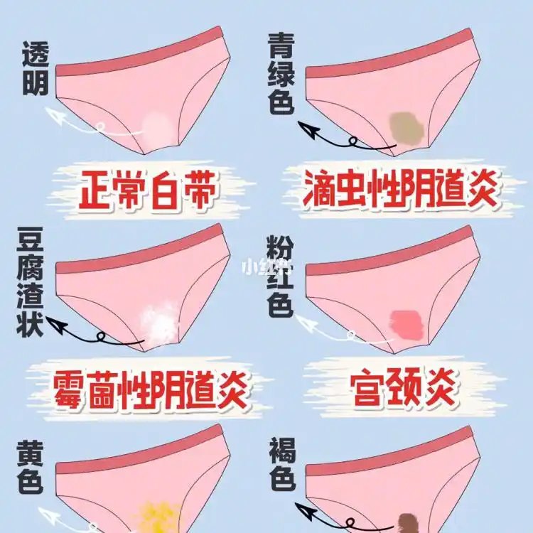 妇科病都会有什么症状呢?