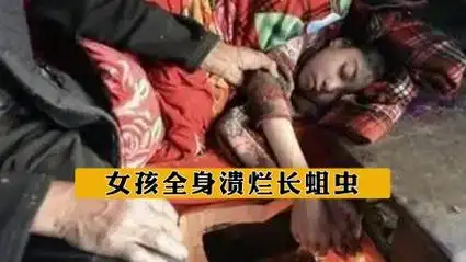 女孩全身溃烂长蛆虫,哭喊想见爸妈一面,父亲:死了直接丢出去