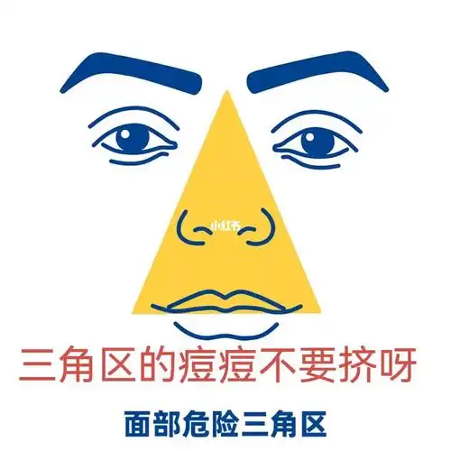 三角区的痘痘不要挤!