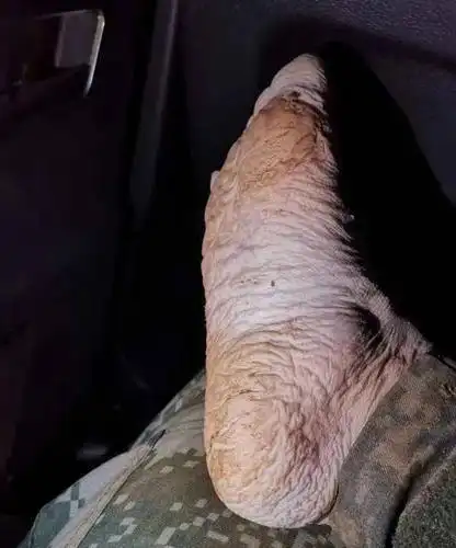 这只脚刷屏了!网友:看着太心疼