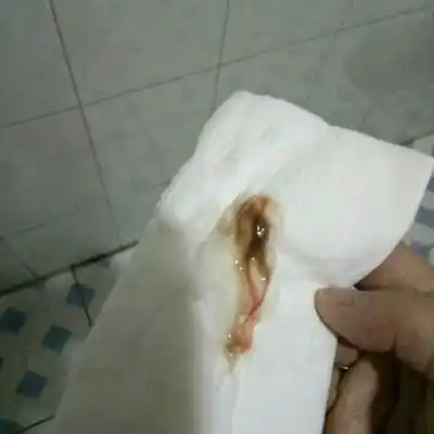 有图慎入,请问这是见红吗?是不是快生了?