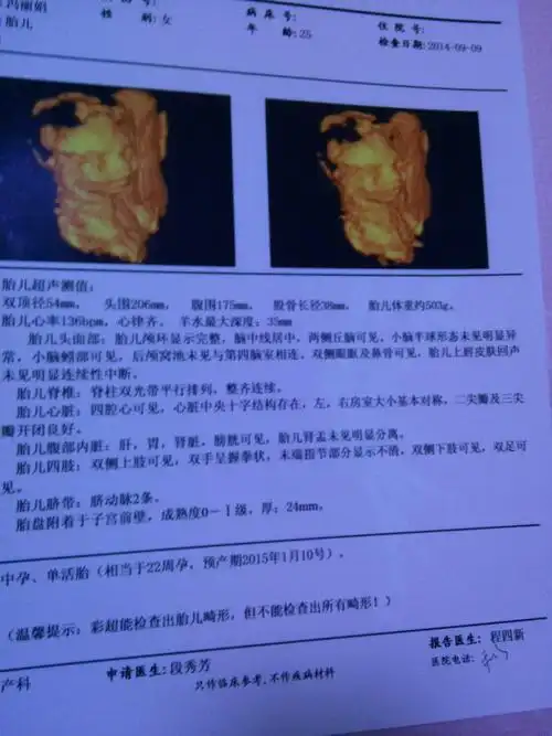 好着急!六个月四维彩超男孩图"熙熙攘攘"-第2张图片-伊卡博客