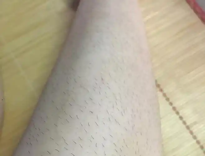 女生永远粗壮大腿的同时还给了你浓密细长的汗毛真好—完—"可怜一下