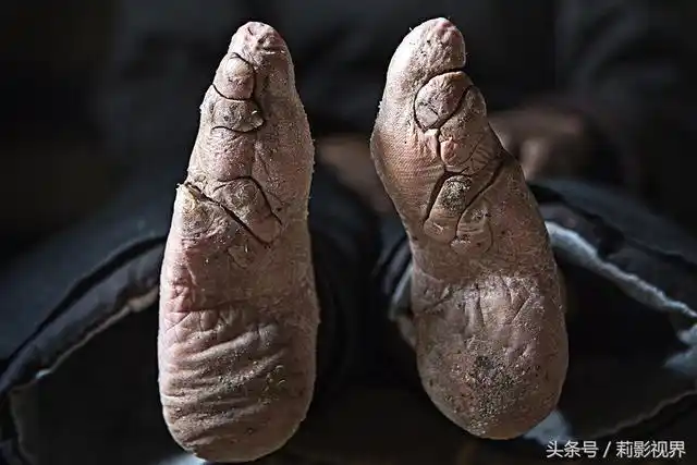 最后的三寸金莲一个耄耋老人的悲喜人生