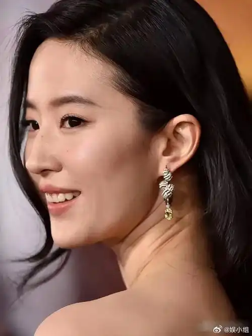 刘亦菲牙龈问题,我有"三"问:1,为什么不去做牙齿矫正,你又不是缺钱的