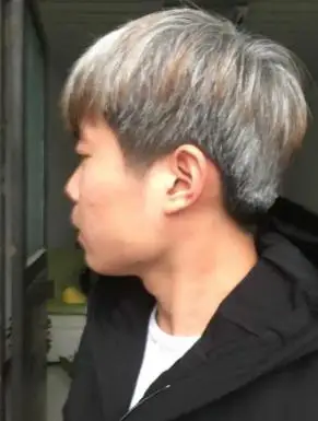 导语:越来越多的年轻人过早地长出白发,是什么导致了白发?