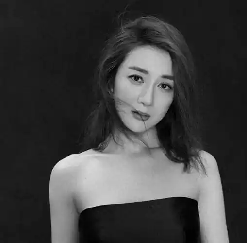 被叶璇的狗咬毁容后,如今即便整容仍难翻身_李依晓_高希希_人生