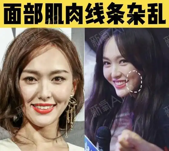 就算是露齿大笑通常笑起来有感染力的特点之一就是面部肌肉线条流畅