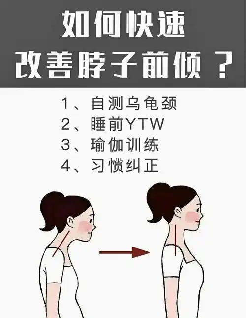 如何改善脖子前倾
