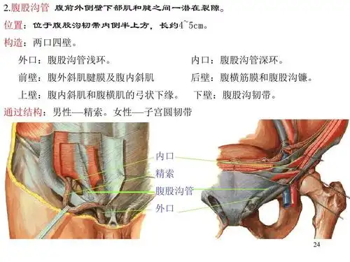 内口 精索 腹股沟管 外口