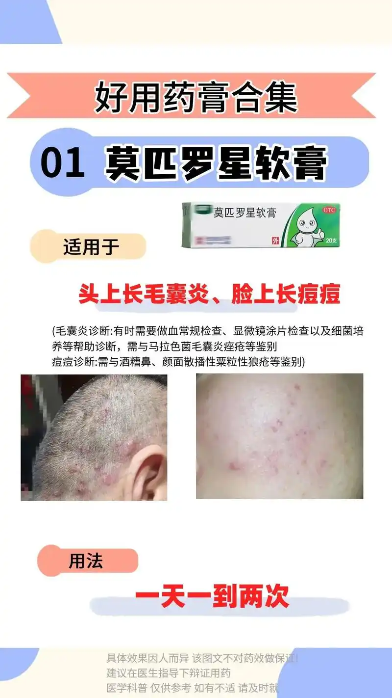 三款好用药膏.#皮肤科 #皮肤问题 #医学健康 - 抖音