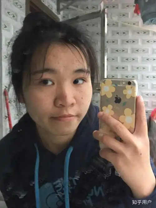 女生长得特别丑怎么办?