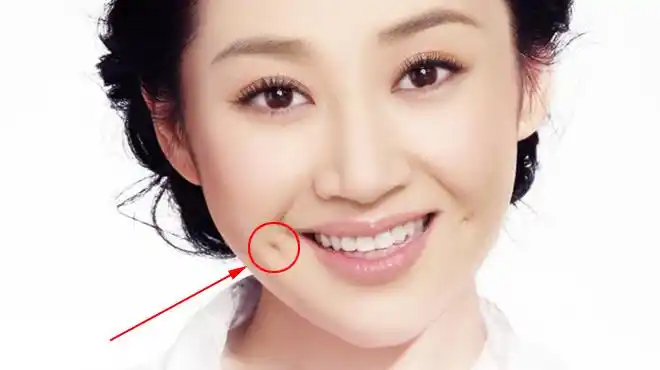 涨姿势,酒窝竟然可以分为4大类,你属于哪一种?