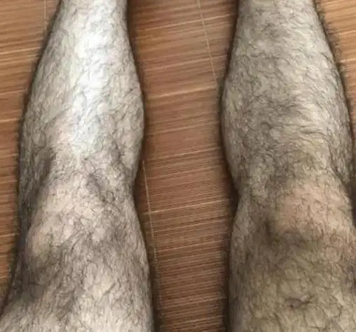 女生长腿毛的原因有哪些吉日(女腿毛运势)