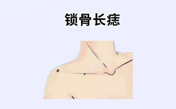 如果女人锁骨下的痣位于锁骨中间,脖子右侧一点为"旺夫痣".