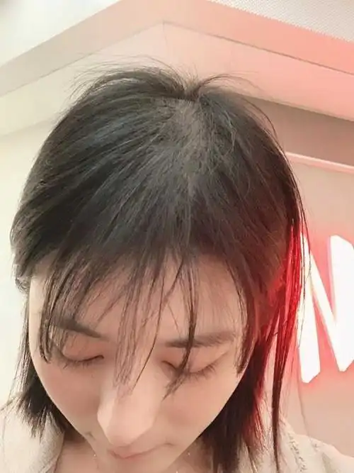 90后女生,因为头发少,自卑,该怎么办? - 知乎