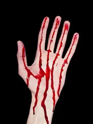 的血688282滴血828233红墨如血滴入水, 白底慢动6330外科医生的双手染