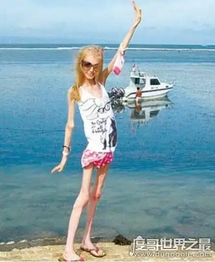 世界上最瘦的女人(体重仅40斤)