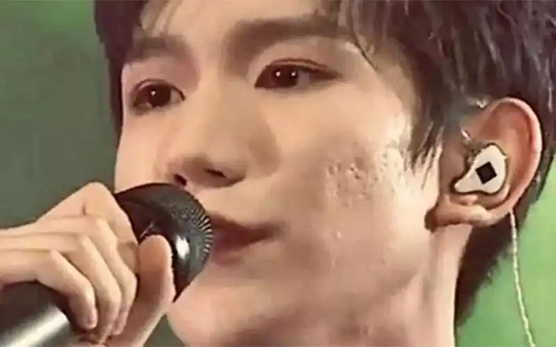 王源镜头下真实颜值曝光,脸部坑坑洼洼被嘲烂脸?网友:别吸烟了