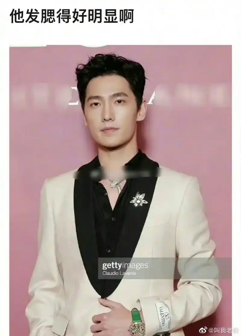 杨洋这应该不算发腮吧,杨洋算是同年龄段男明星中保养得最好的了