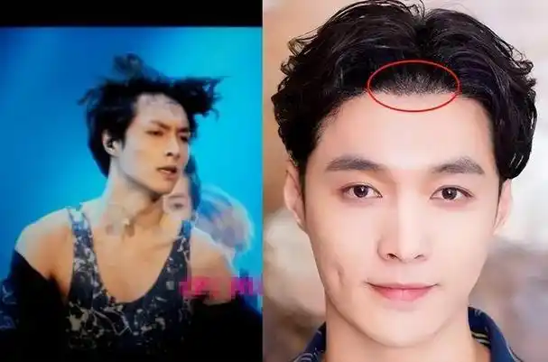 这6位男神中年秃顶,从郑少秋到黄晓明,个个发际线高到离谱!